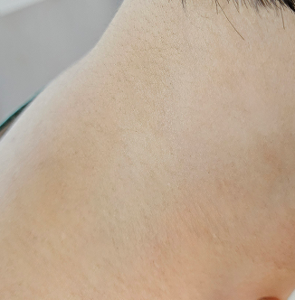 제품 사용 후 피부